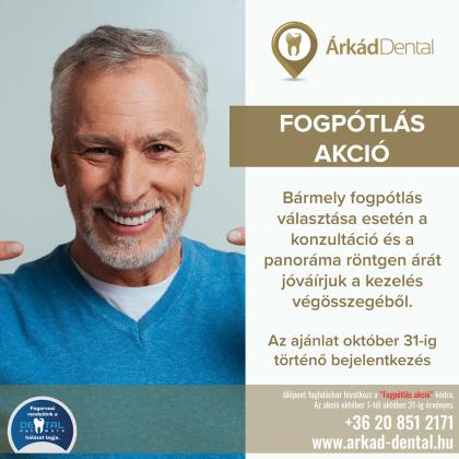Fogpótlás akció Fogpótlás akció