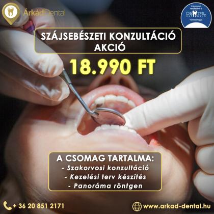 Szájsebészeti Konzultáció Akció Szájsebészeti Konzultáció Akció