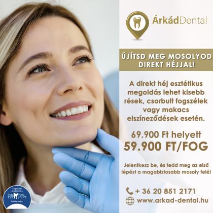 Direkt héj akció