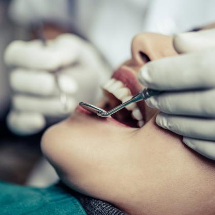 Gyökérkezelés menete: így zajlik lépésről lépésre az Árkád Dentalban