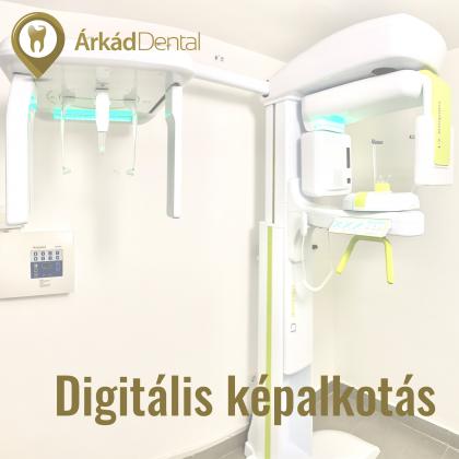 Digitális képalkotás - CT - Haifa Dent és Dentium Implant Centerben érhető el