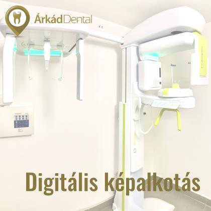 Digitális képalkotás - CT - Haifa Dent és Dentium Implant Centerben érhető el Digitális képalkotás - CT - Haifa Dent és Dentium Implant Centerben érhető el