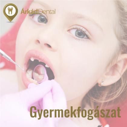 Gyermekfogászat - a kicsik fogászati prevenciója